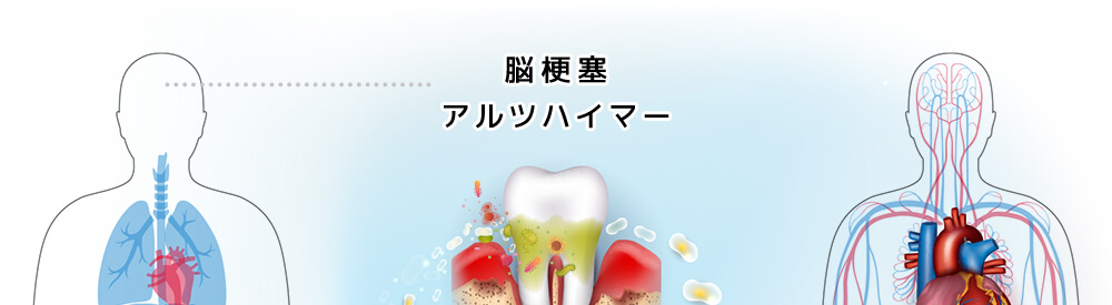 歯周病は糖尿病の合併症の一つ