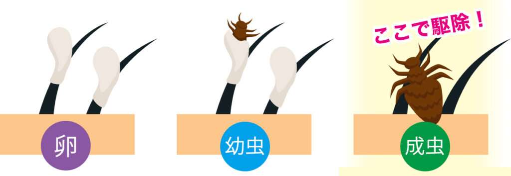 8日以上駆除し続ける