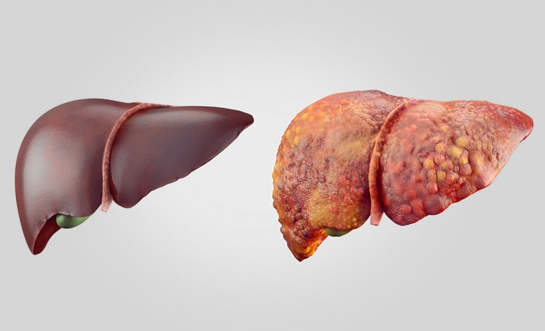 下げる 納豆 数値 肝臓 肝臓に良い食べ物・飲み物｜肝臓に悪い食べ物・食品